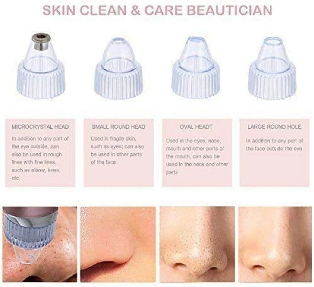 Pore Vacuum Blackhead Remover