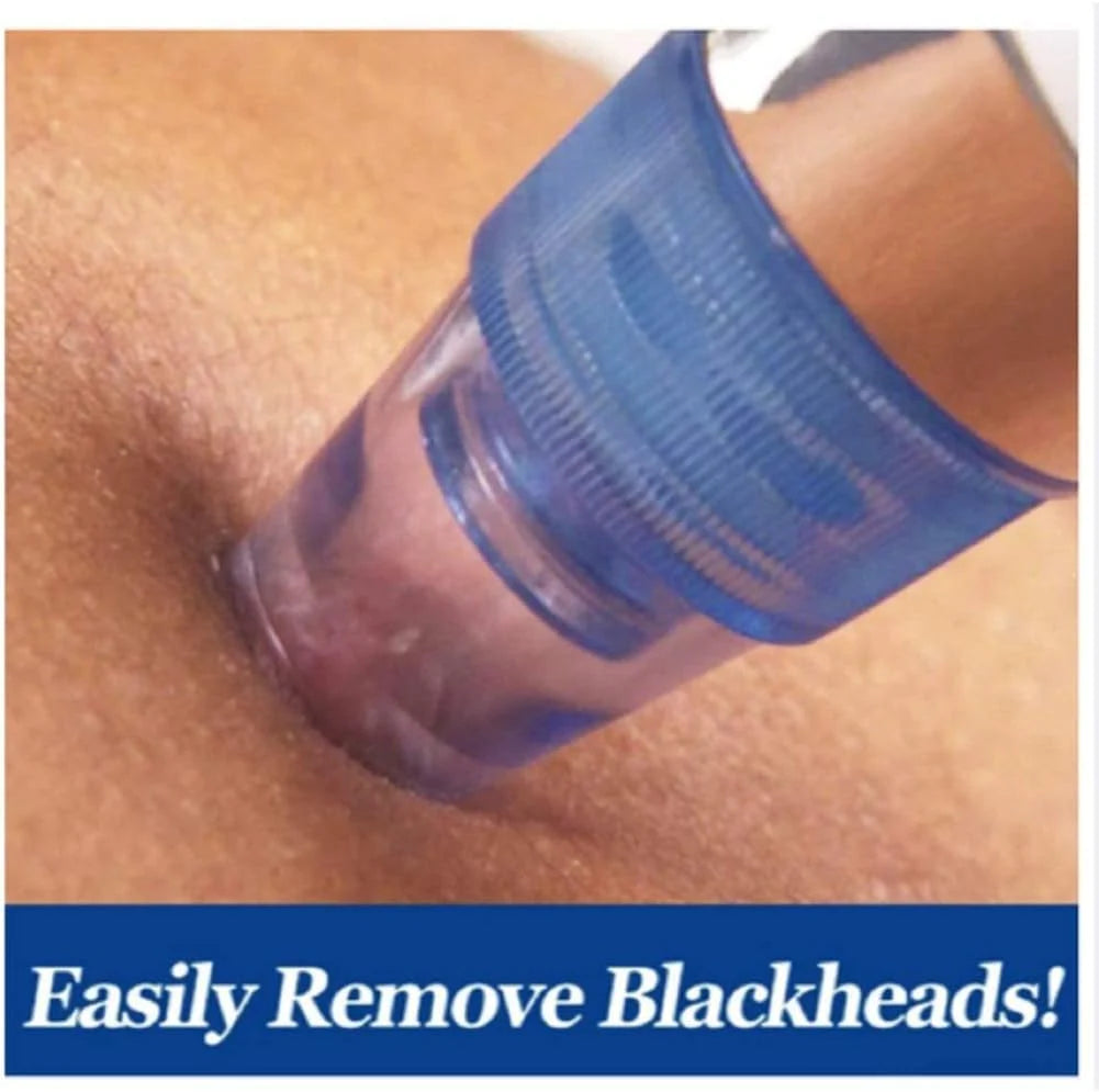 Pore Vacuum Blackhead Remover